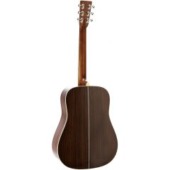 C.F. Martin & Co HD-28 Sunburst - Vue 2